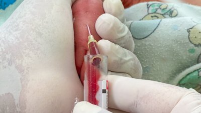 Baby blood sampling for diagnostic lab tests done by a nurse with a partial view of hand in latex gloves